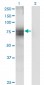 ITM1 Antibody (monoclonal) (M02)